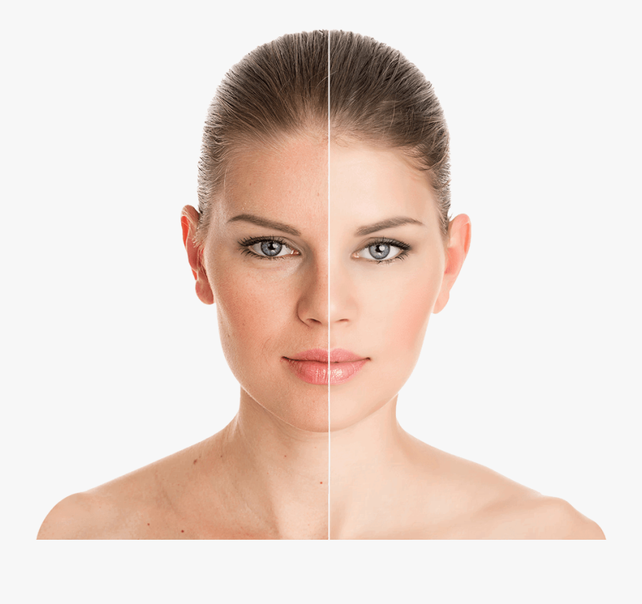 Clip Art Skin Imageediting - Skin Retouching Before And After, Transparent Clipart