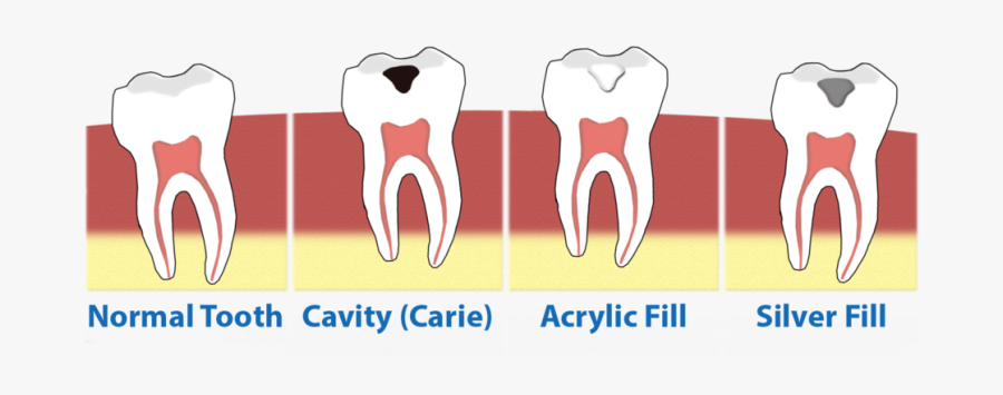 Dentist Clipart Dental Sealant - Congratulations Baby Shower, Transparent Clipart