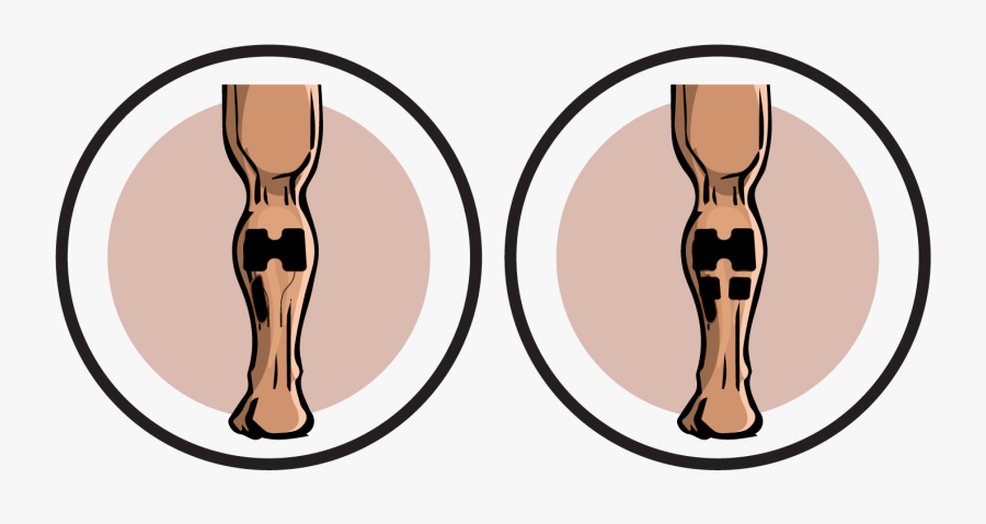 Calves Electrode Pad Placements - Hi, Transparent Clipart