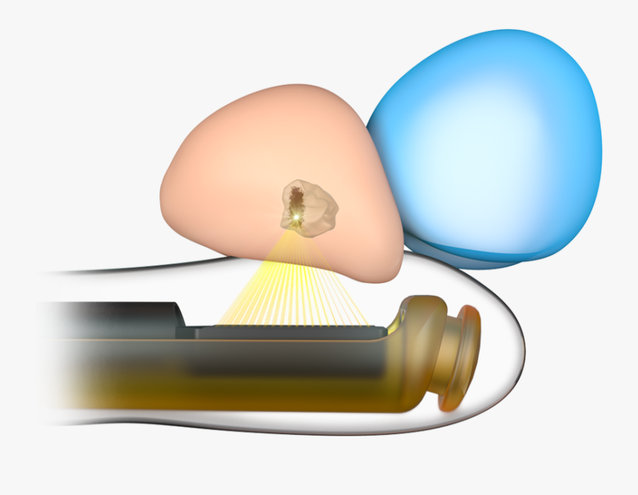 Egg, Transparent Clipart