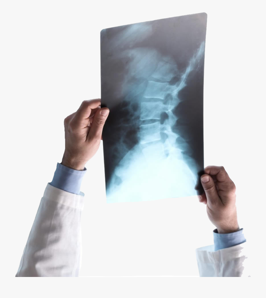 About Southwest X-ray - Do Bulging Discs Cause Pain, Transparent Clipart