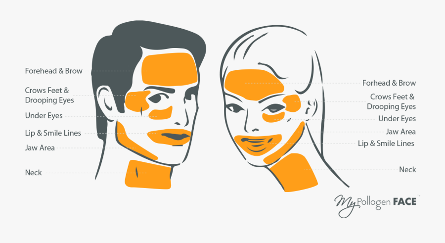 S2 - Tripollar Regen, Transparent Clipart