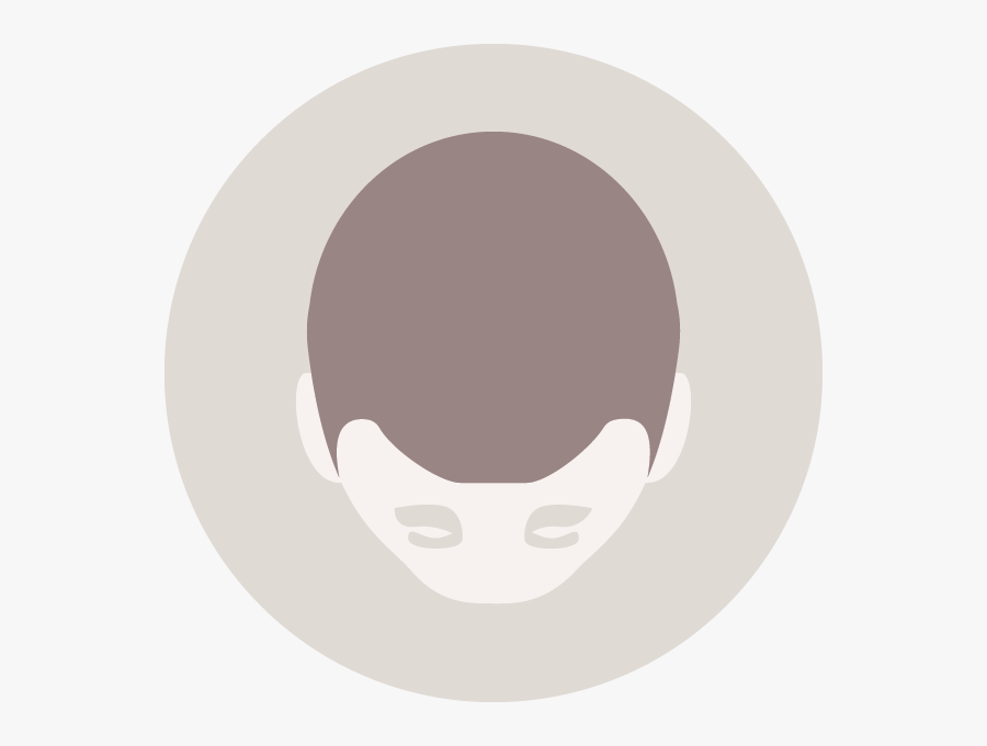 Men"s Hair Loss - Circle, Transparent Clipart