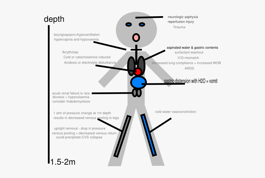 Stick Figure Pathophysiology Of Drowning Svg Clip Arts - Pathophysiology Of Drowning Diagram, Transparent Clipart