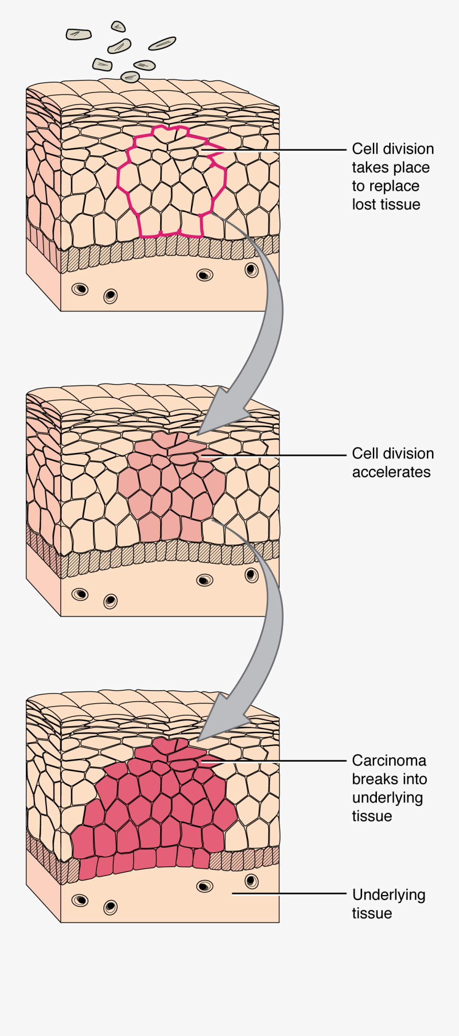 Cell Clipart Malignant - Tissue Repair Diagram, Transparent Clipart