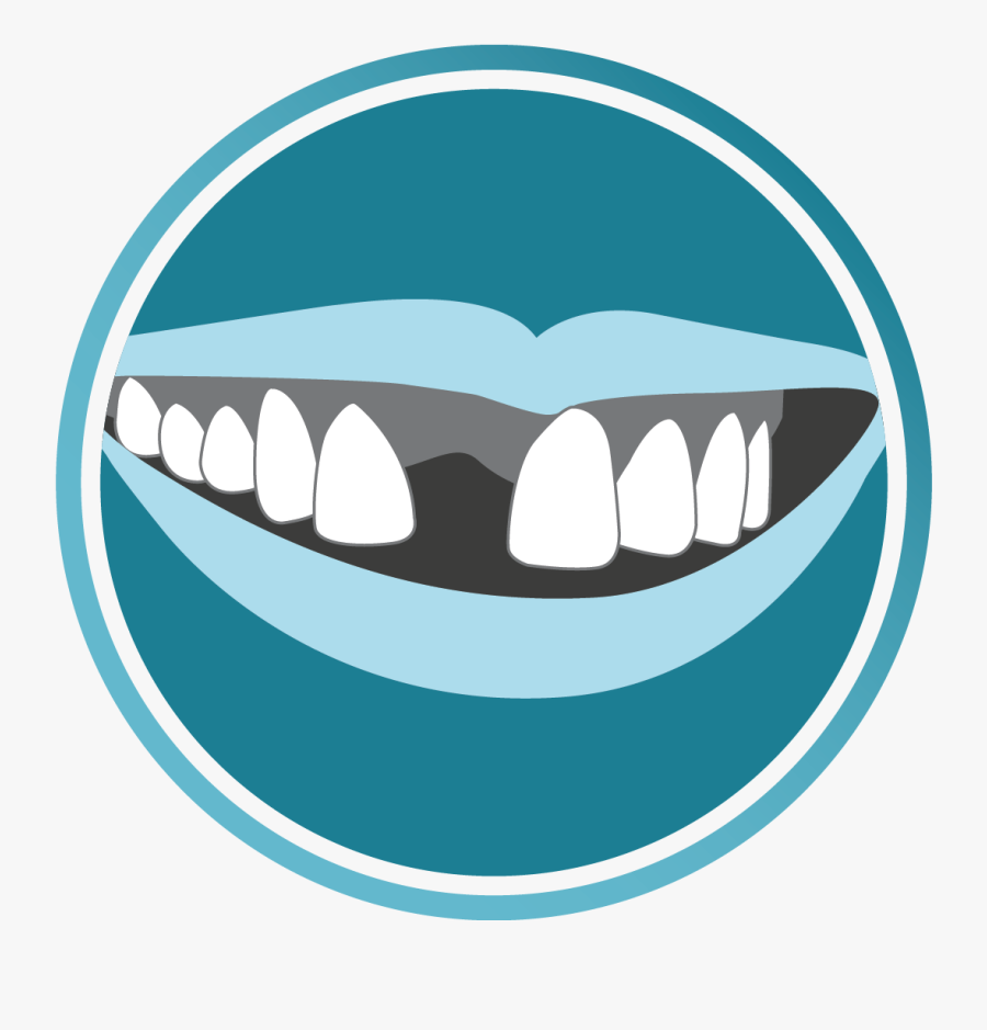 Clipart Smile Brace, Transparent Clipart