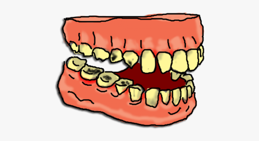 Teeth Clipart Dental Cleaning - Rotten Teeth Clipart, Transparent Clipart