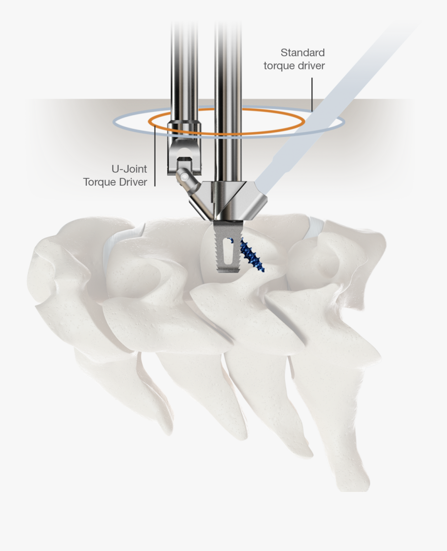 U-joint Torque Driver - Stand Alone Cervical Driver, Transparent Clipart