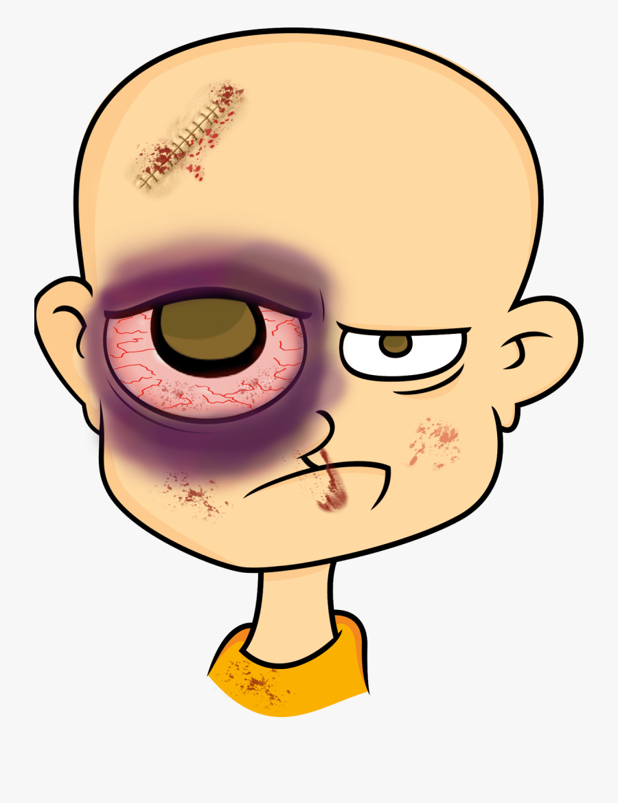 Eyebrow Clipart Eyelid - Cartoon With Black Eye, Transparent Clipart