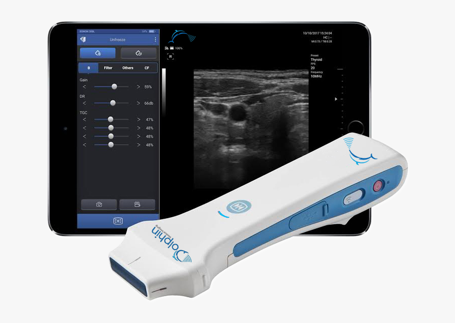 Healcerion Ultrasound, Transparent Clipart