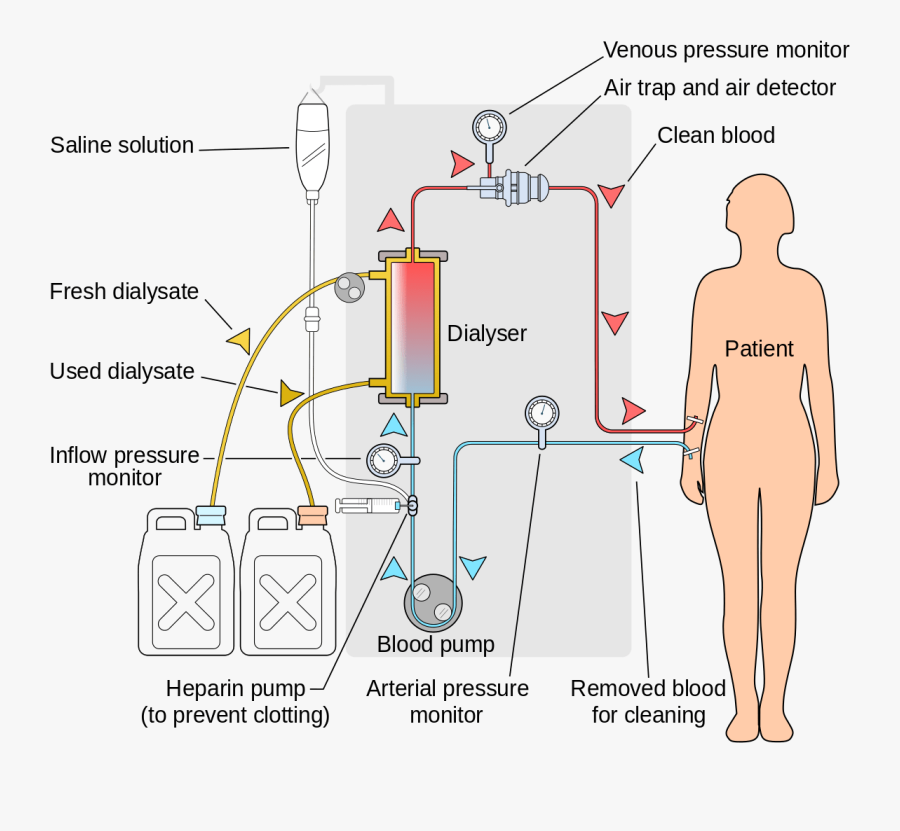 Renal Dialysis, Transparent Clipart