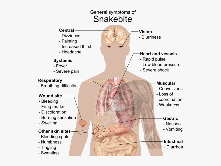 Transparent Png Snake - General Symptoms Of Snake Bite, Transparent Clipart