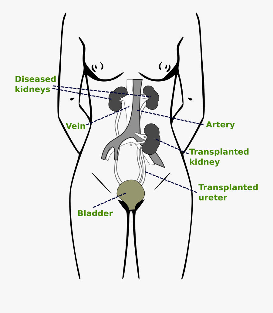 Transplantable Organs, Transparent Clipart