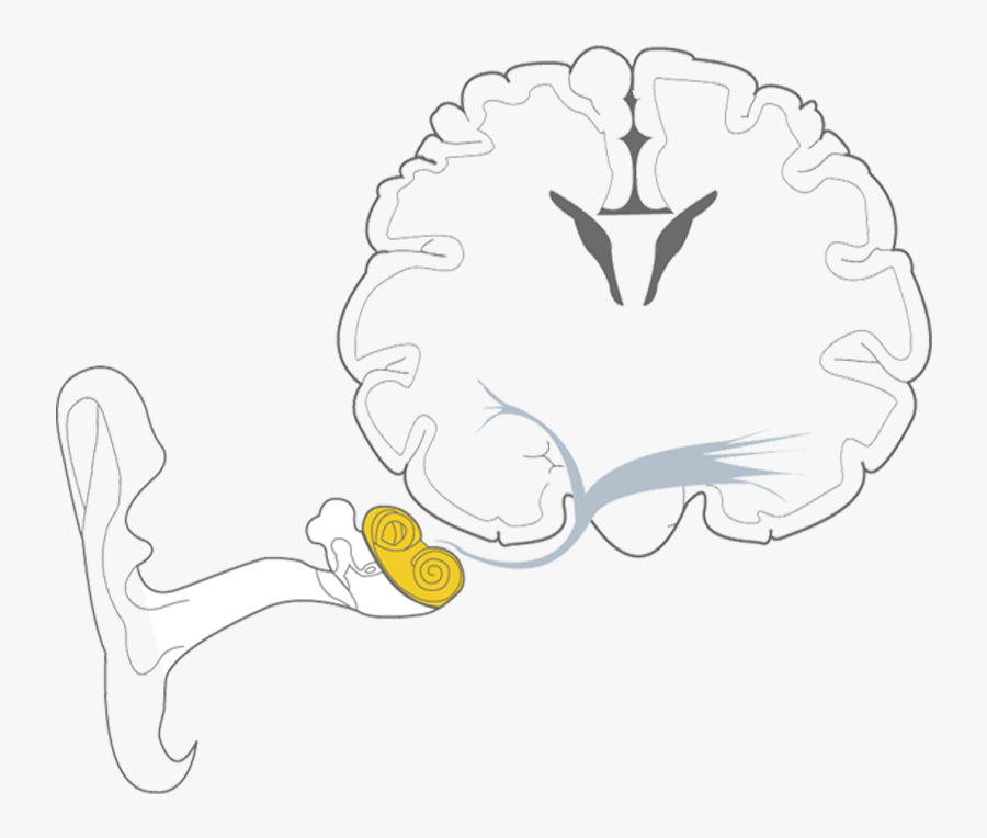 Sensorineural Hearing Loss , Transparent Cartoons - Sensorineural Hearing Loss, Transparent Clipart