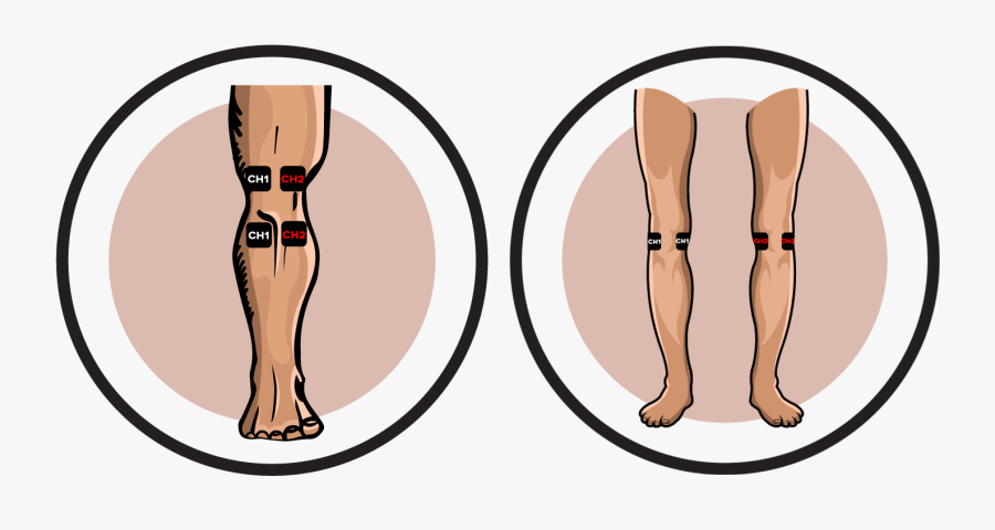 Bicep Clipart Triceps - Tens Pad Placement For Elbow Pain, Transparent Clipart