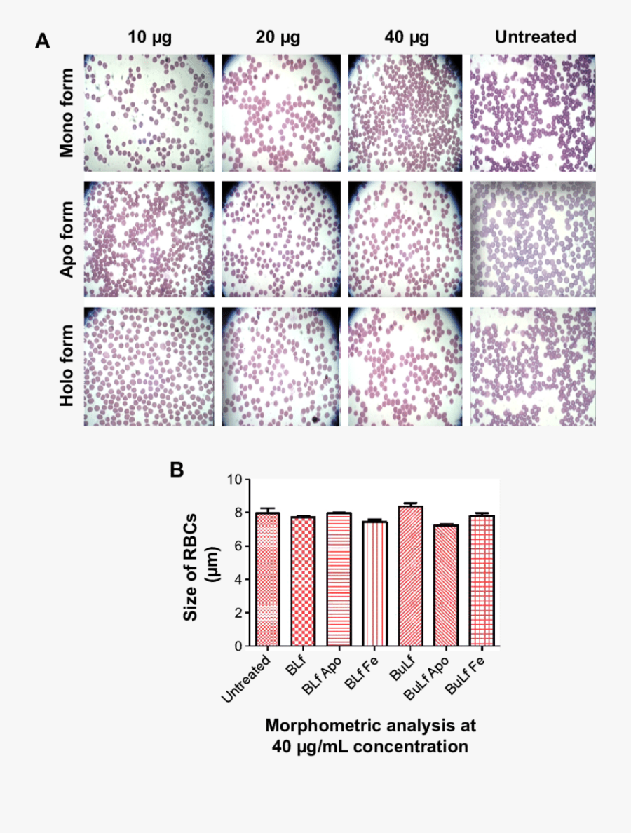 Giemsa Stain Microscopy Of Red Blood Cells Treated - Lilac, Transparent Clipart