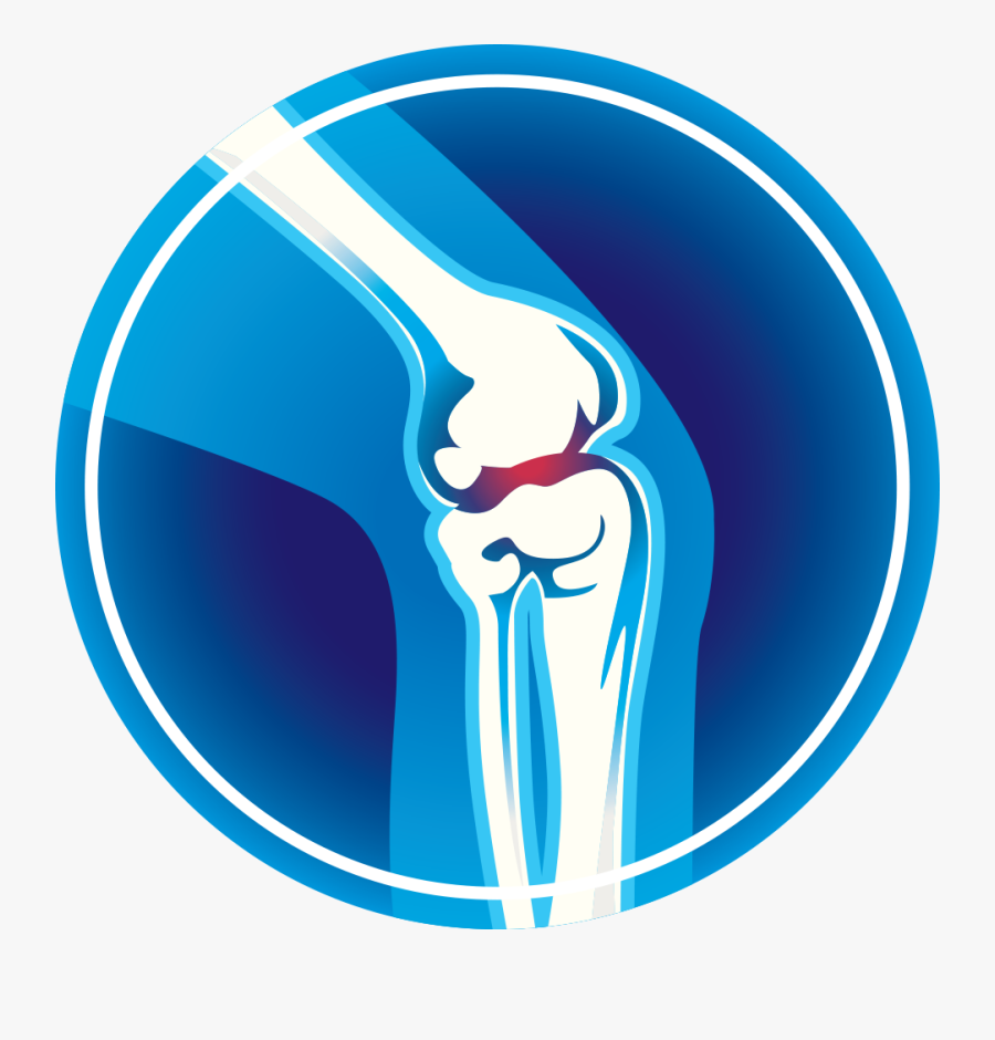 Arthritis Monroe Clinic Did - Arthritis Png, Transparent Clipart