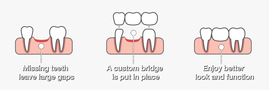 South Point Family Dentistry, Transparent Clipart