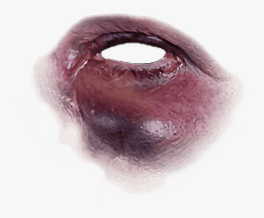 Black Eye - Bruise Black Eye Transparent, Transparent Clipart