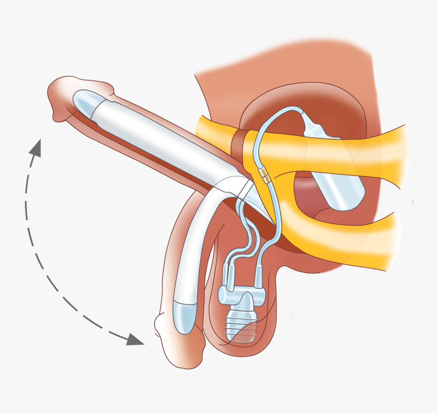 Thumb Image - Aloe Vera And Honey Benefits, Transparent Clipart