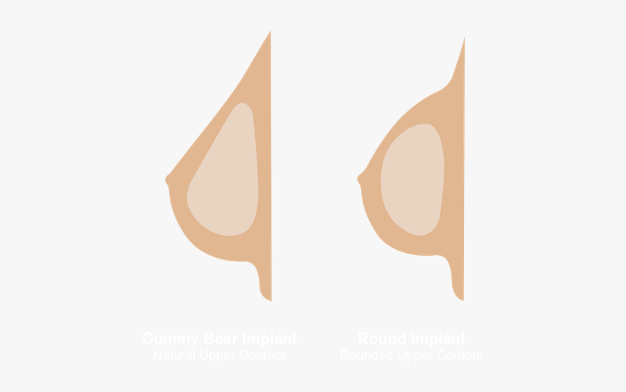 Image Of Gummy Bear Implants - Gummy Bear Drop Implants, Transparent Clipart