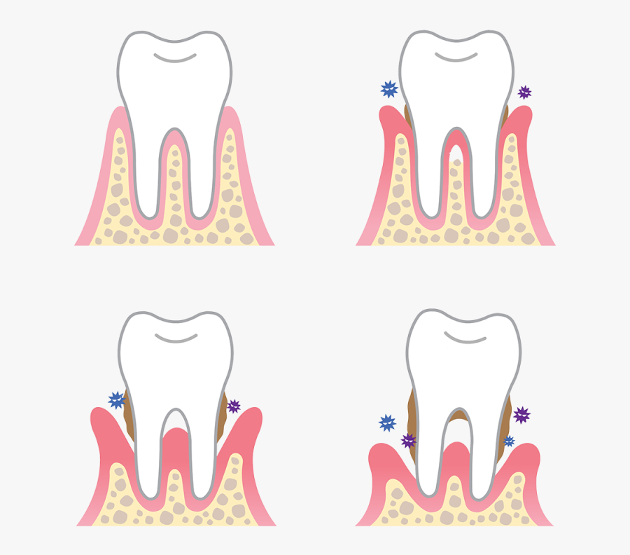 Dental Smile Clipart - Dental Periodontal, Transparent Clipart