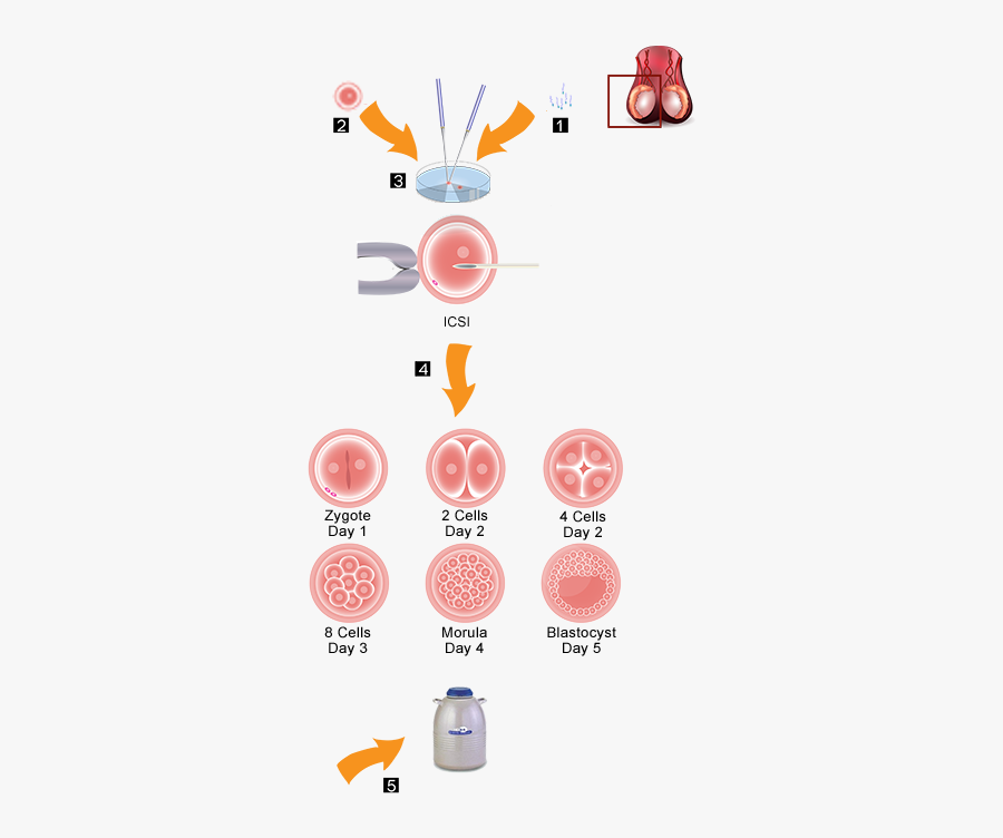 Frozen Donor Egg Procedure - Fécondation In Vitro Définition, Transparent Clipart
