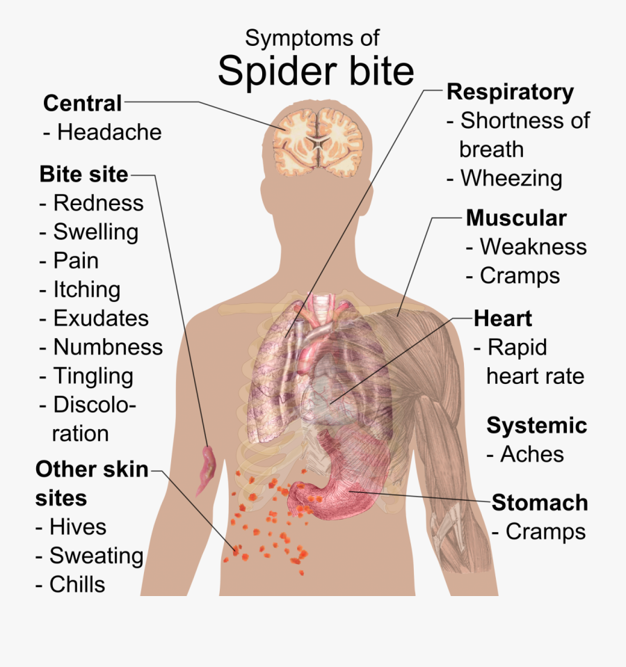 Transparent Bite Mark Png - Sac Spider Bite Pictures South Africa, Transparent Clipart