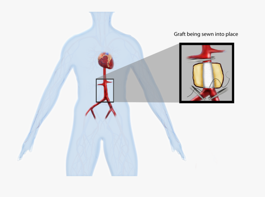 04 - Illustration, Transparent Clipart