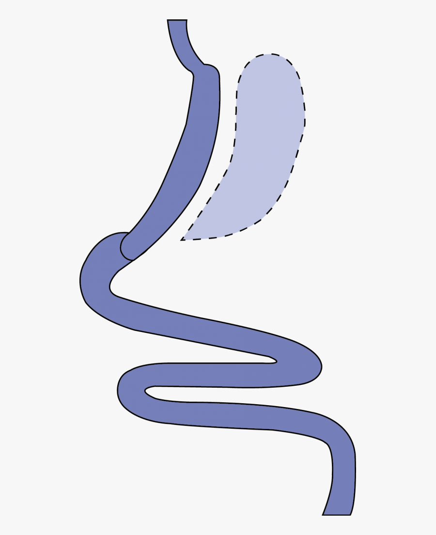 Stomach Clipart Diagram, Transparent Clipart