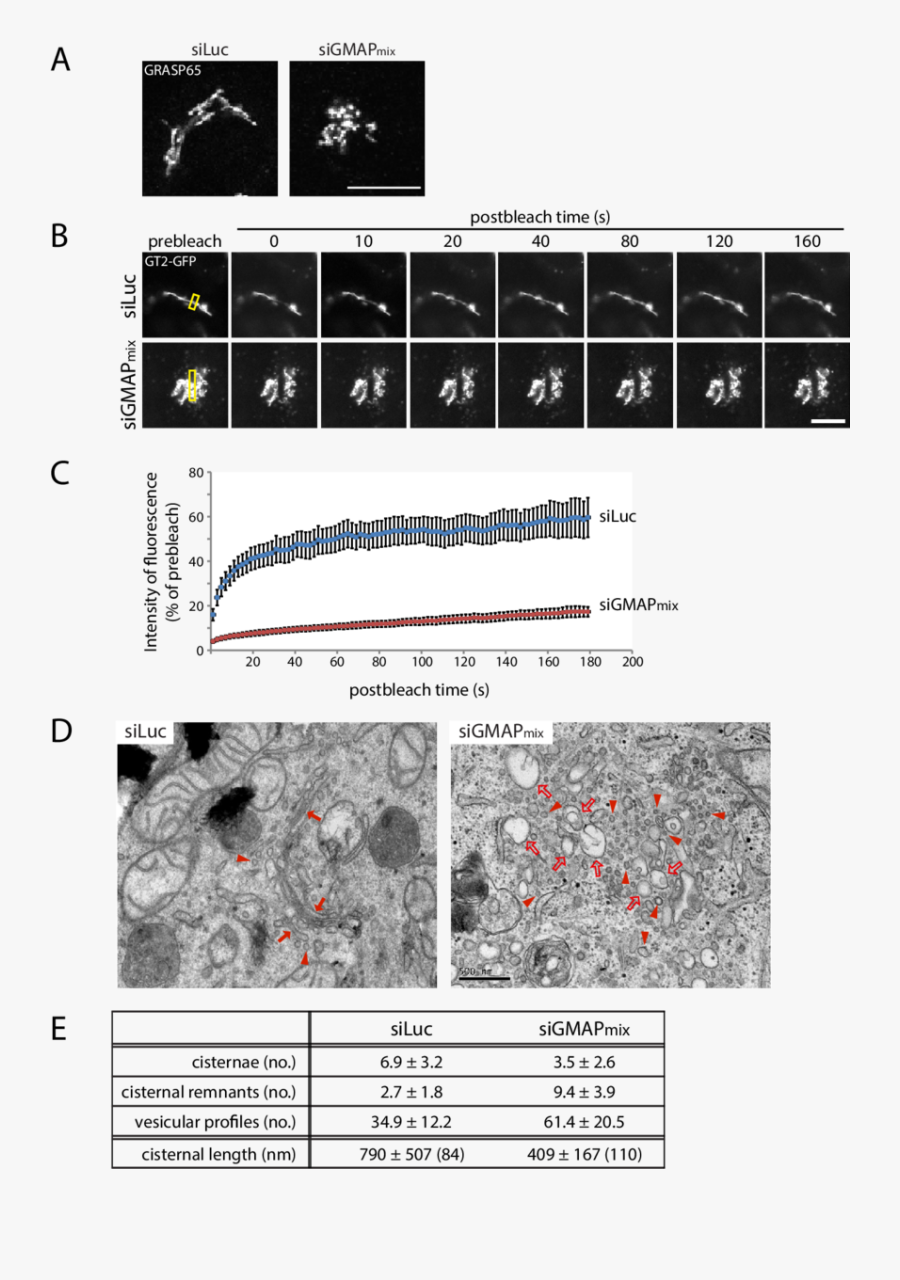 Depletion Of Gmap 210 Vesiculates Golgi Stacks - Colorfulness, Transparent Clipart