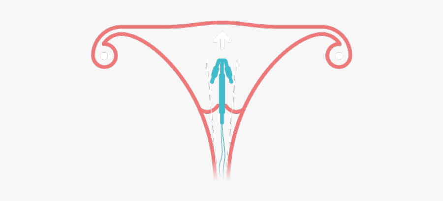 No Hormones Cliparts - Non Hormonal Coil, Transparent Clipart