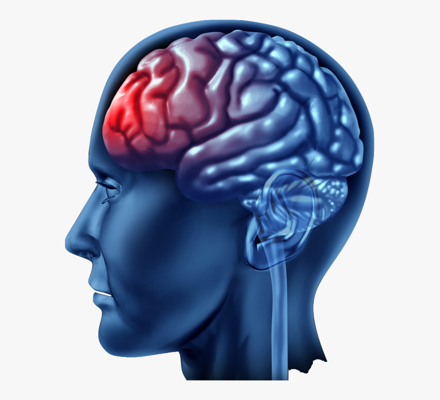 Types Of Injuries In Personal Injury Accidents - Acquired Brain Injury, Transparent Clipart