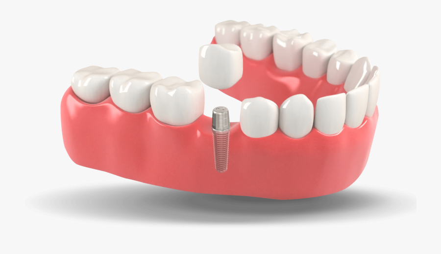 Menu-image - Tooth Booth Dentists, Transparent Clipart