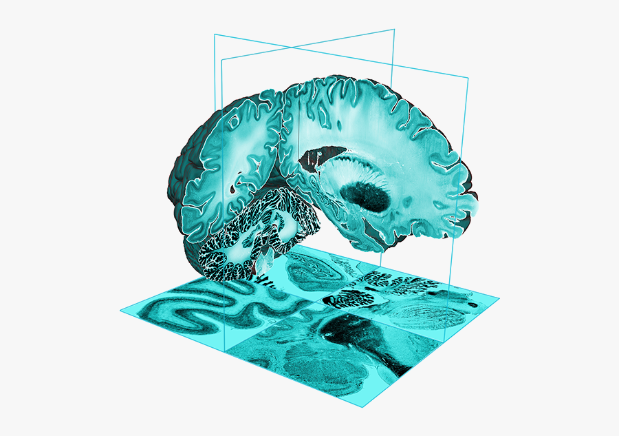Big Brain Atlas 3d, Transparent Clipart