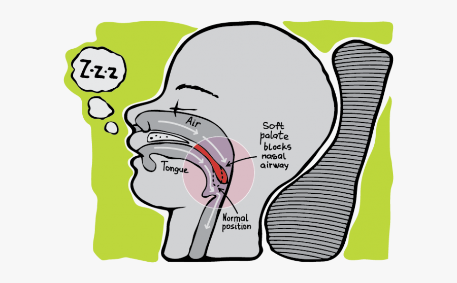 Best Remedy For Snoring, Transparent Clipart