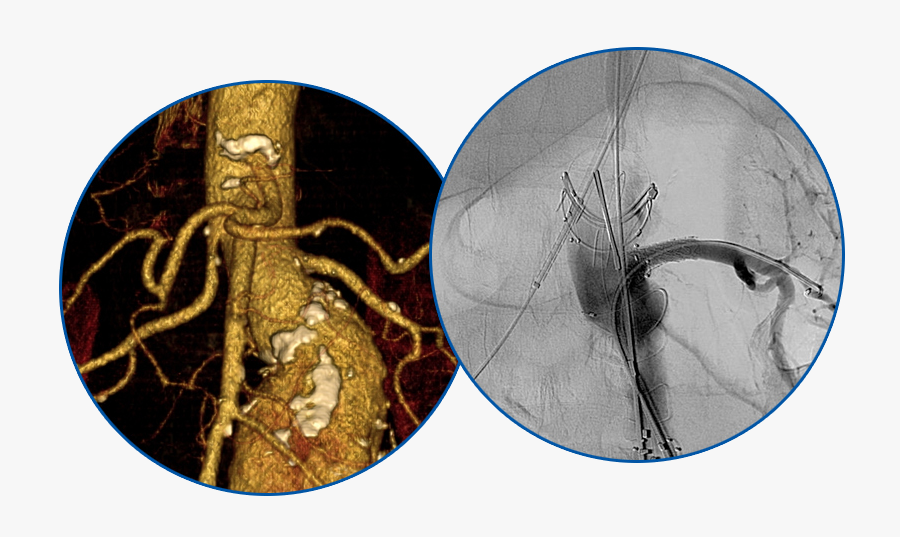 Circle, Transparent Clipart