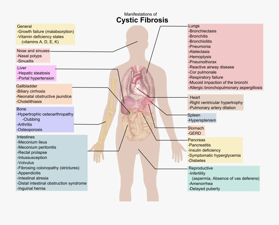 Organ Systems Of Body - Cystic Fibrosis Affects The Body, Transparent Clipart