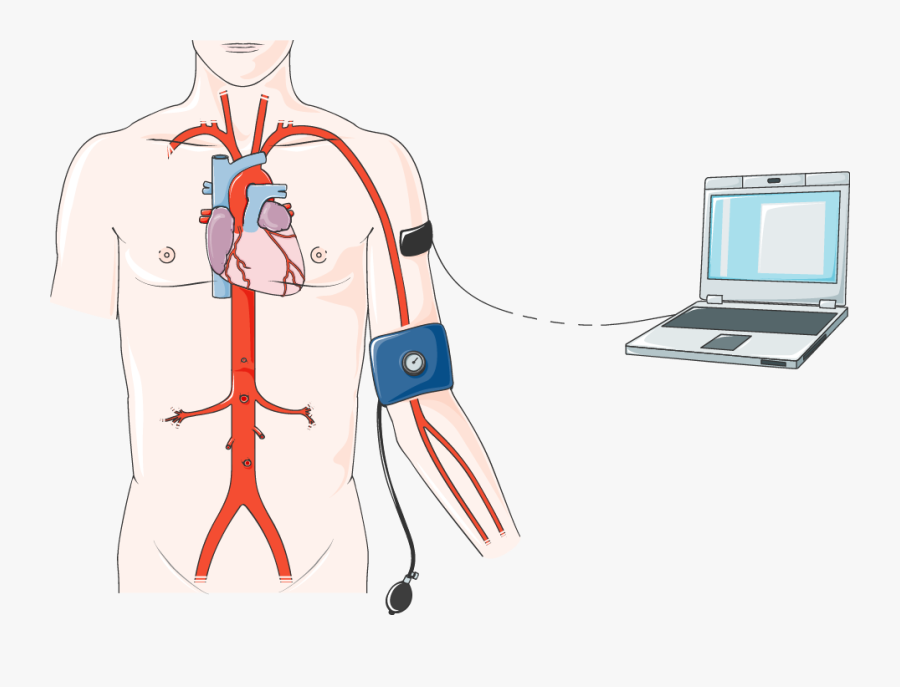 Pression Artérielle - Angioplasty, Transparent Clipart