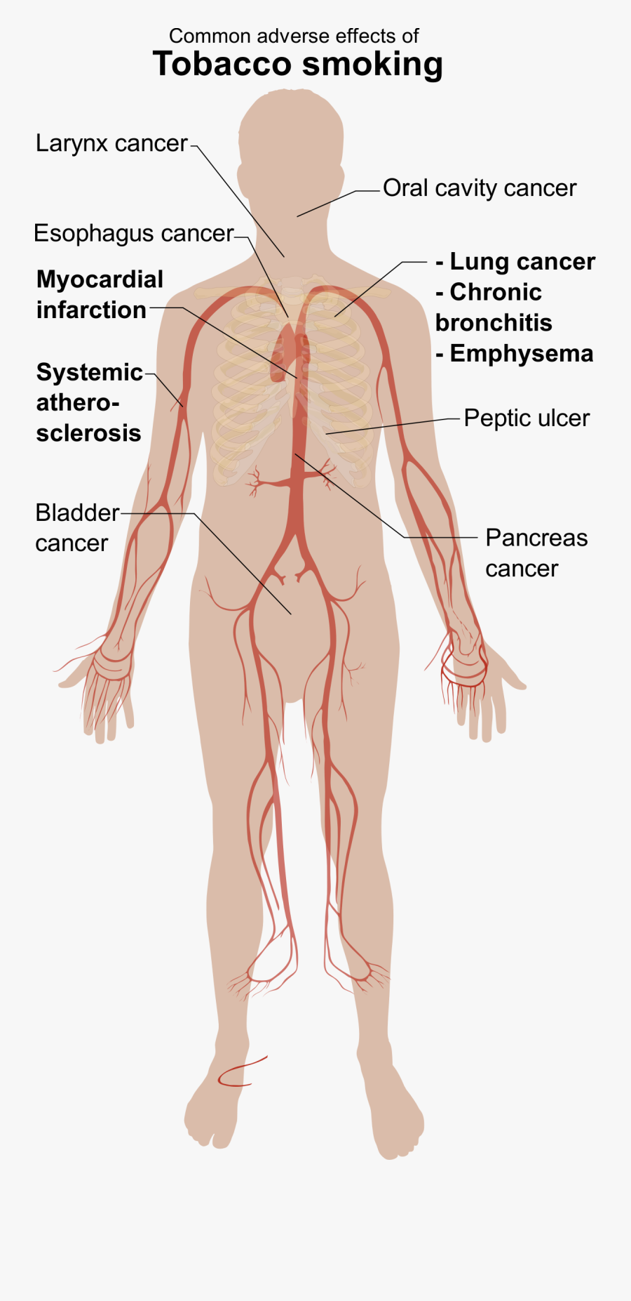 Adverse Effects Of Tobacco Smoking - Tobacco The Silent Killer, Transparent Clipart
