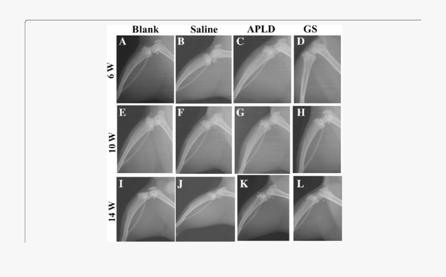 Clip Art The X Ray Images - Computed Tomography, Transparent Clipart
