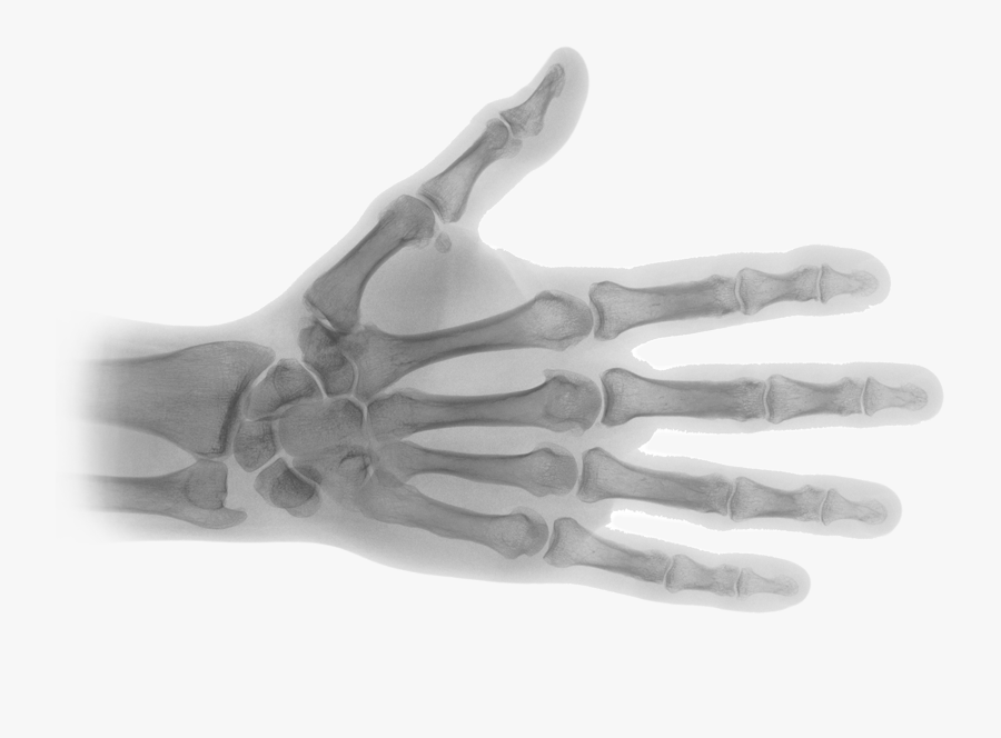 X Ray Png - X Ray Hand Png, Transparent Clipart