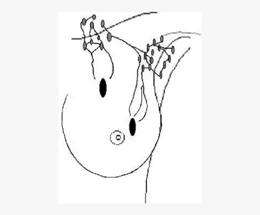 Kd Drawing Breast Cancer - Breast Cancer Right Inner Upper Quandrant, Transparent Clipart