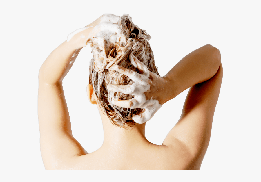 Léger Psoriasis Cuir Chevelu, Transparent Clipart