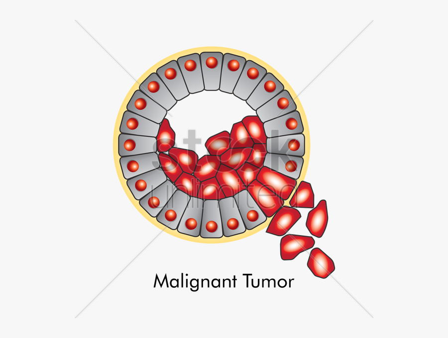Benign Tumor Clipart, Transparent Clipart