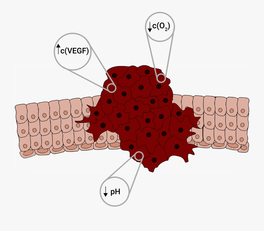 Transparent Tumor Png, Transparent Clipart