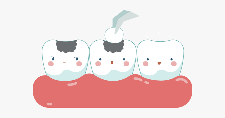 Dental Filling Cartoon, Transparent Clipart