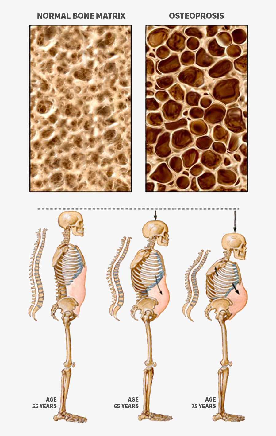 Endocrinology Of Central Pa - Side Effect Of Lays, Transparent Clipart