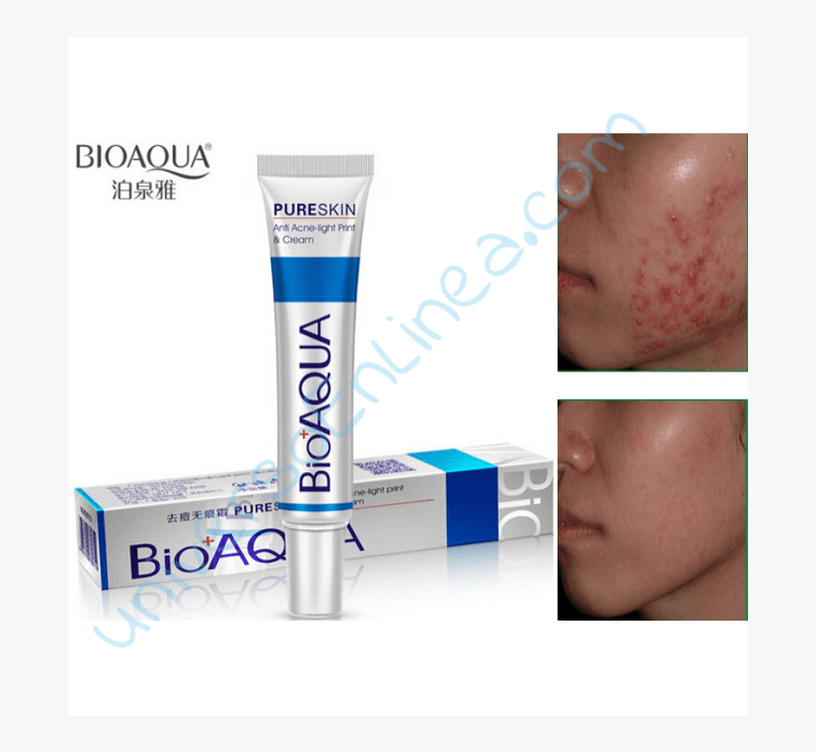 Clip Art Crema Bioaqua Pure Skin - Bioaqua Anti Acne Treatment 30g, Transparent Clipart