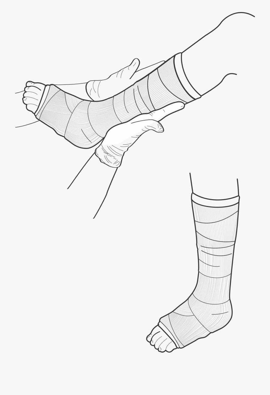 Leg Drawing At Getdrawings - Drawings Of Leg Casts, Transparent Clipart